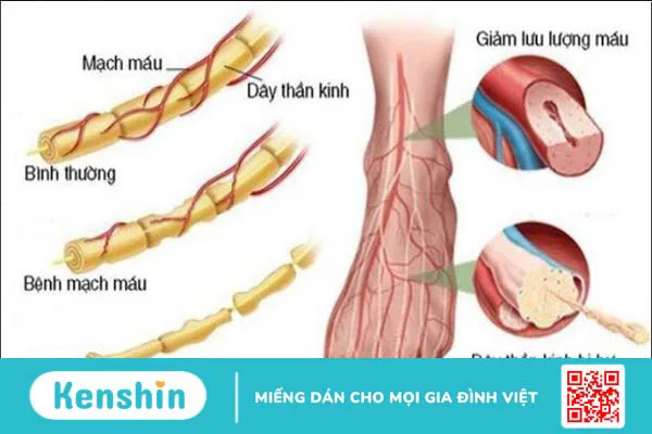 Omega 6 là gì? Tác dụng, cách dùng, tác dụng phụ, thực phẩm chứa omega 6