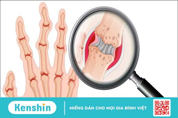 Omega 6 là gì? Tác dụng, cách dùng, tác dụng phụ, thực phẩm chứa omega 6