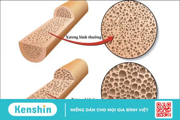 Omega 6 là gì? Tác dụng, cách dùng, tác dụng phụ, thực phẩm chứa omega 6