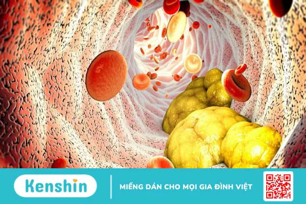 Omega 6 là gì? Tác dụng, cách dùng, tác dụng phụ, thực phẩm chứa omega 6