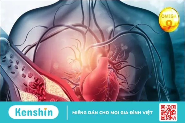 Omega 9 là gì? Tác dụng, cách dùng, thực phẩm chứa omega 9