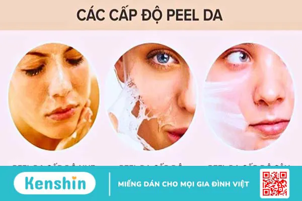 Peel da có tốt không? 11 tác dụng, lưu ý hiện tượng sau khi peel da