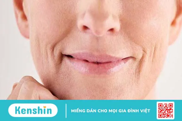 Peel da có tốt không? 11 tác dụng, lưu ý hiện tượng sau khi peel da