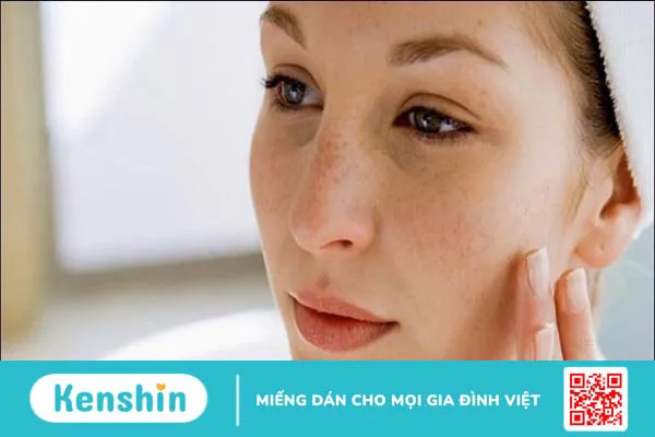 Peel da có tốt không? 11 tác dụng, lưu ý hiện tượng sau khi peel da