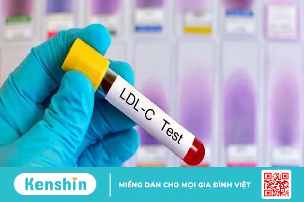 Phân biệt giữa LDL cholesterol và HDL cholesterol