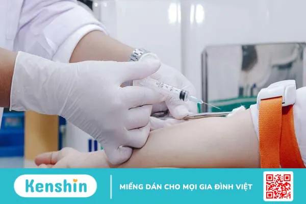 Phương pháp điều trị cường giáp bạn nên biết