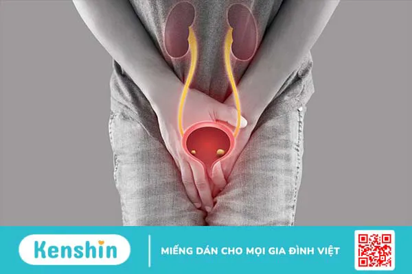 Phương pháp điều trị sỏi niệu quản bạn không nên bỏ qua