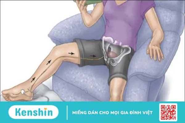 Phương pháp điều trị viêm bàng quang kẽ bạn không nên bỏ qua