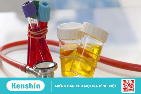 Phương pháp điều trị viêm mào tinh hoàn bạn nên biết