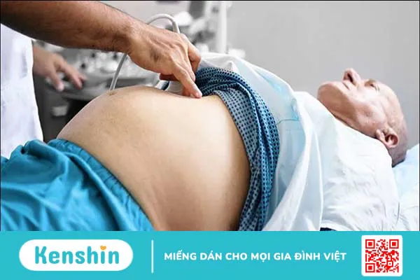 Phương pháp điều trị xơ gan bạn không nên bỏ qua