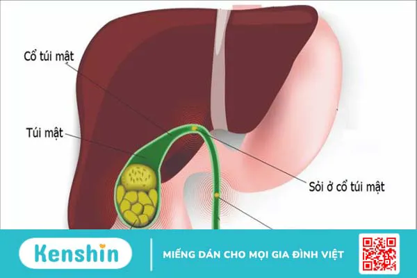 Quả cóc có tác dụng gì? 18 lợi ích sức khỏe của quả cóc