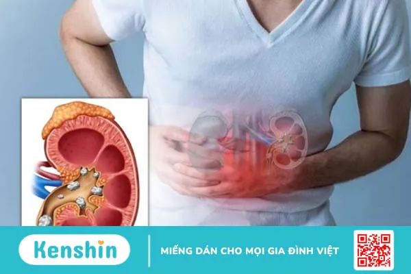 Quả lựu có tác dụng gì? 22 công dụng, lưu ý ăn lựu tốt cho sức khỏe