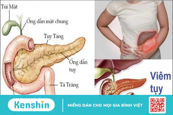 Quai bị có lây không? 4 nguy cơ lây nhiễm và biện pháp phòng ngừa