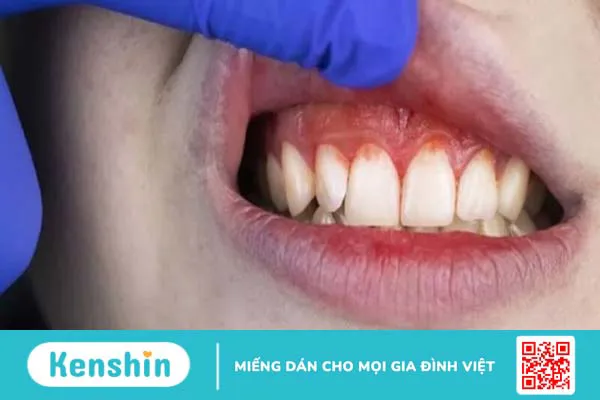 Quan hệ bao lâu thì thụ thai? 21 dấu hiệu mang thai sau 1 tuần quan hệ