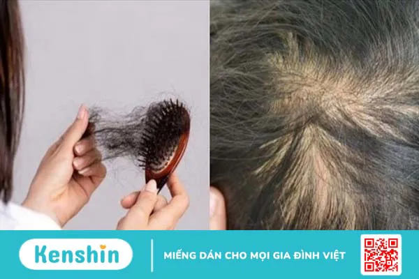 Quan hệ bao lâu thì thụ thai? 21 dấu hiệu mang thai sau 1 tuần quan hệ