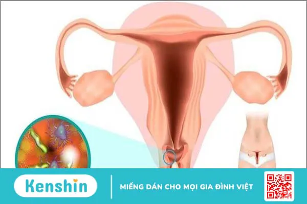 Quan hệ ngày đèn đỏ có hại không? 6 lợi ích và các lưu ý khi quan hệ