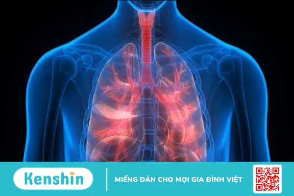 Quế hoa là gì? 11 công dụng của quế hoa đối với sức khỏe bạn nên biết