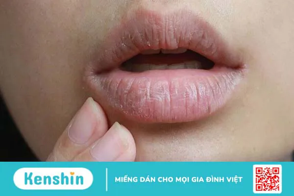 Rát lưỡi là bệnh gì? 5 nguyên nhân gây rát lưỡi, khô miệng kéo dài