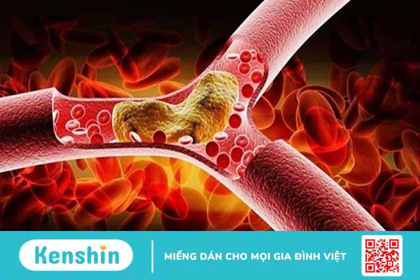 Rau cần tây có tác dụng gì? 19 lợi ích và các lưu ý khi dùng cần tây