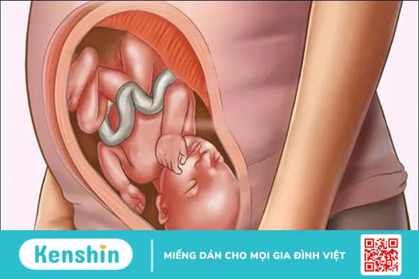 Rau cần tây có tác dụng gì? 19 lợi ích và các lưu ý khi dùng cần tây