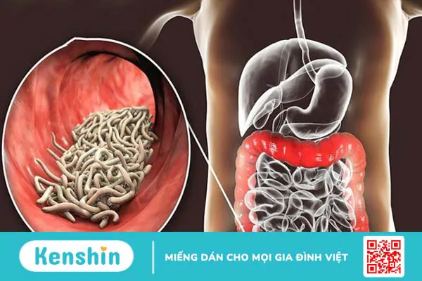 Rau đắng đất có tác dụng gì? 11 bài thuốc chữa bệnh từ rau đắng đất