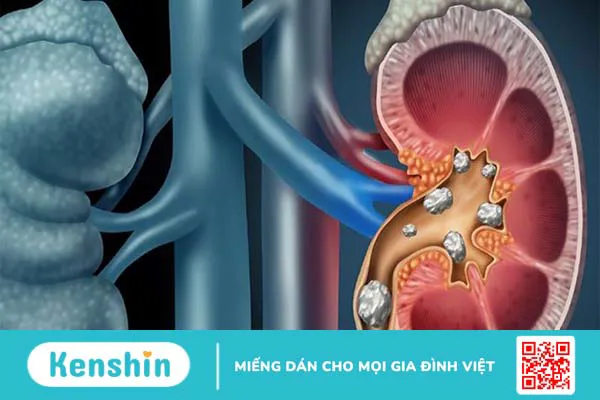 Rau dền có tác dụng gì? 8 công dụng của rau dền với sức khỏe