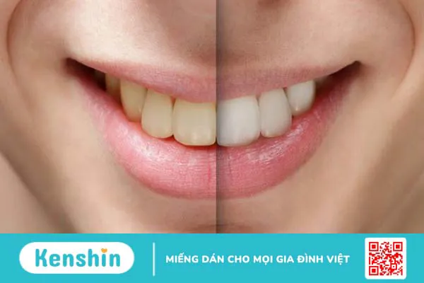 Rau dền có tác dụng gì? 8 công dụng của rau dền với sức khỏe