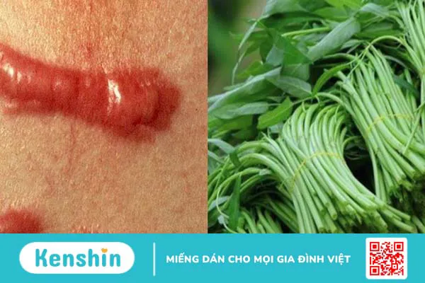 Rau muống có tác dụng gì? Có nên ăn rau muống mỗi ngày?