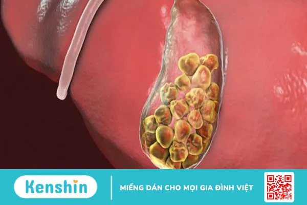 Rau xà lách xoong có tác dụng gì? 27 công dụng của xà lách xoong