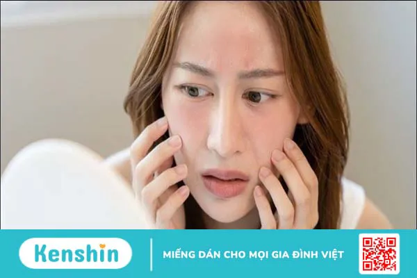 Retinol có thể trị mụn trứng cá không? Cách sử dụng retinol trị mụn đúng cách, an toàn