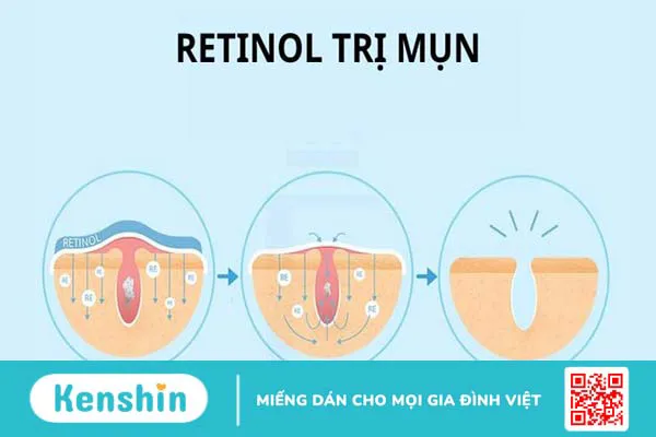 Retinol là gì? Tác dụng, cách dùng, tác dụng phụ và lưu ý bạn nên biết