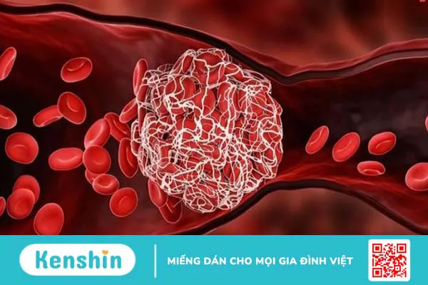 Rutin: Tác dụng, cách dùng, tác dụng phụ, thực phẩm chứa rutin