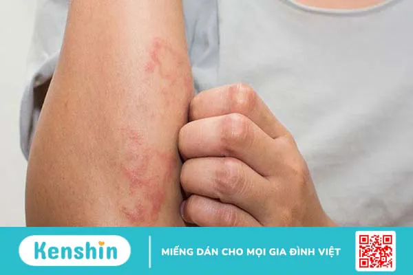 Sáp ong có tác dụng gì? 12 công dụng của sáp ong, bài thuốc và lưu ý