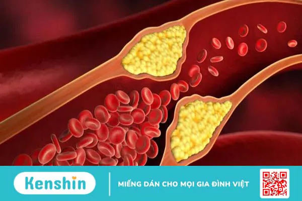 Sáp ong có tác dụng gì? 12 công dụng của sáp ong, bài thuốc và lưu ý