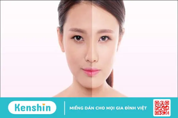 Serum Vitamin C có tác dụng gì với da mặt? Lưu ý khi dùng vitamin C