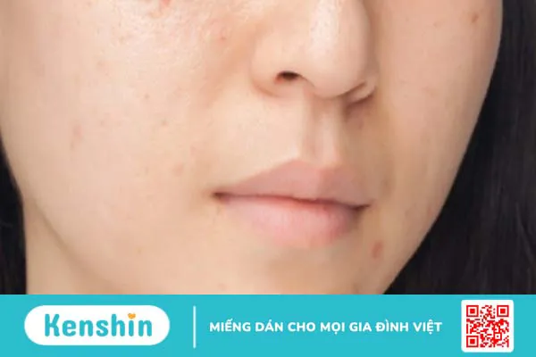 Serum Vitamin C có tác dụng gì với da mặt? Lưu ý khi dùng vitamin C