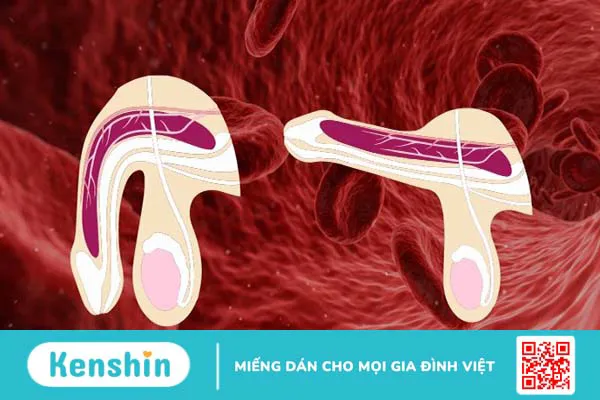 Sử dụng L-Arginin trong điều trị rối loạn cương dương