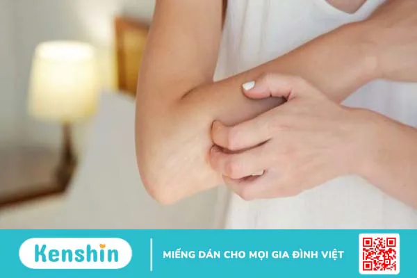 Sử dụng sữa dưỡng thể bị ngứa và cách khắc phục khi bị dị ứng mỹ phẩm