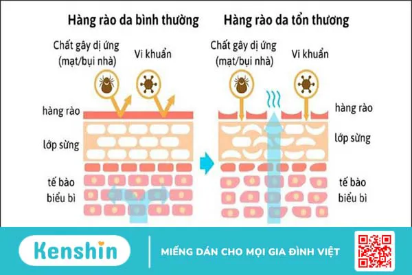 Sữa dưỡng thể có tác dụng gì? 11 tác dụng và cách sử dụng hiệu quả