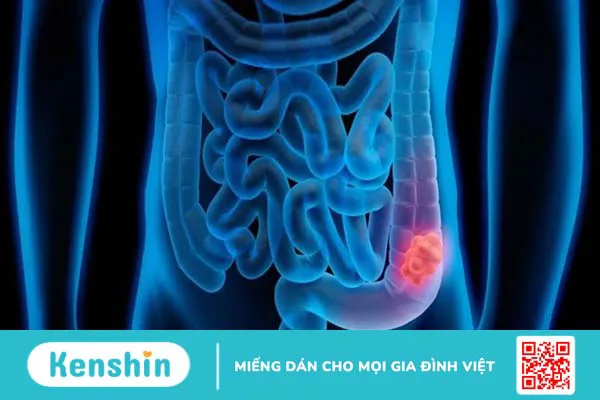 Sữa không đường bao nhiêu calo? Uống sữa không đường có béo không?