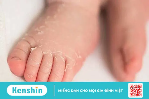 Tác dụng của thuốc aspirin, liều lượng và một số lưu ý khi sử dụng