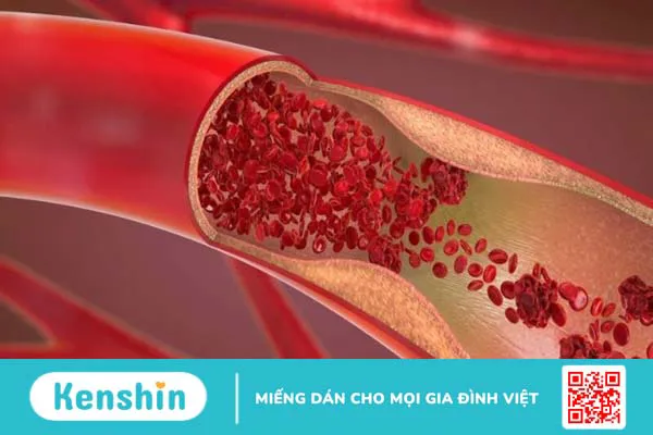 Tác dụng của vitamin C là gì? Cách sử dụng vitamin C hiệu quả, an toàn