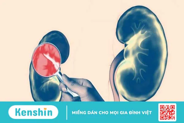 Tác hại khi thừa vitamin D bạn cần biết