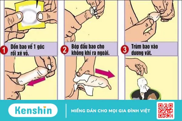 Tại sao dùng bao cao su vẫn có thai? 10 nguyên nhân, cách xử lý