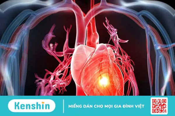 Tại sao không nên ăn quá nhiều đường