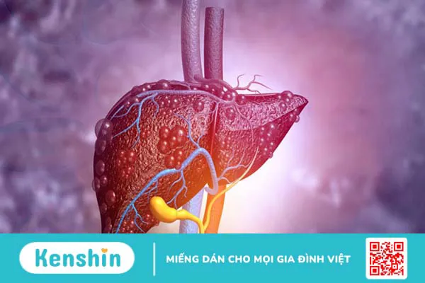 Tại sao không nên ăn quá nhiều đường