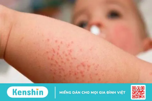 Tại sao phải cho trẻ uống vitamin A? Những lưu ý cha mẹ cần ghi nhớ