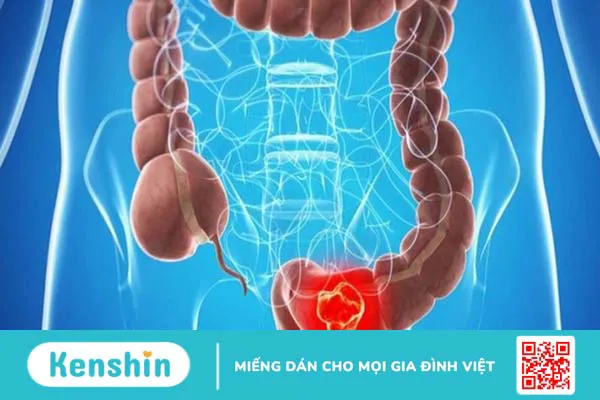 Táo bón nên ăn gì và kiêng gì? Lưu ý cho người táo bón