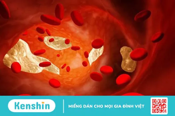 Tảo xoắn spirulina là gì? 11 công dụng của tảo xoắn đối với sức khỏe