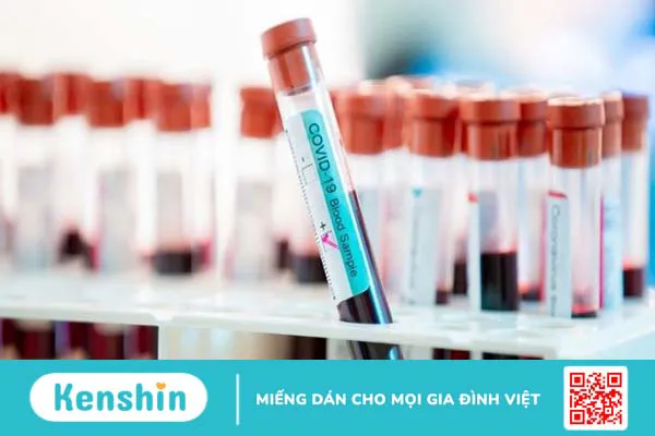 Test PCR Covid là gì? Bao lâu có kết quả? Test như thế nào?